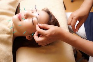 美容鍼サロン Shimogamo メニュー・料金 スタンダードコース