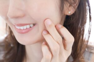 女性　口角引き上げ｜表情筋と美容鍼の関係｜顔の印象が変わる理由とは？